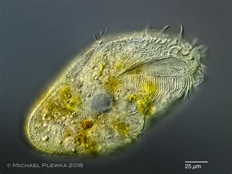  Urostyla! A Single-Celled Symphony of Cilia and Feasting